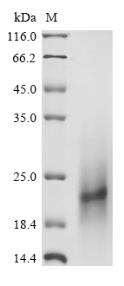 SDS-PAGE (Prg4-5499H).jpg